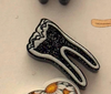 Dental Daisy , RCT and Black Glitter Earrings