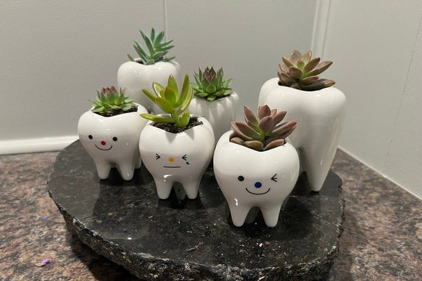 Molar Vase, Dental Vase, Tooth Vase, Dental Planter, Tooth Planter, Dental Hygiene Gift, Dental Succulents, Tooth Succulent, Tooth Shape Pot