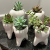 Molar Vase