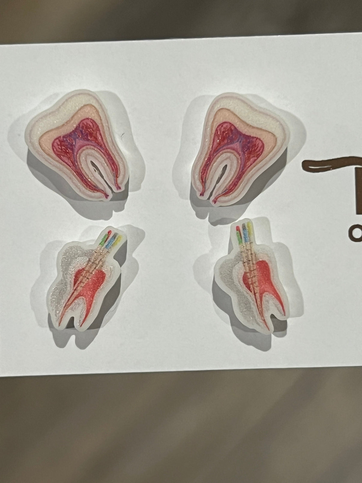 Root Canal Anatomy Earrings: Glitter Tooth Studs, Dental Gift