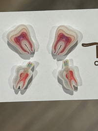 Root Canal Anatomy Earrings: Glitter Tooth Studs, Dental Gift