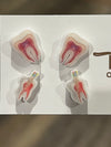 Root Canal Earrings
