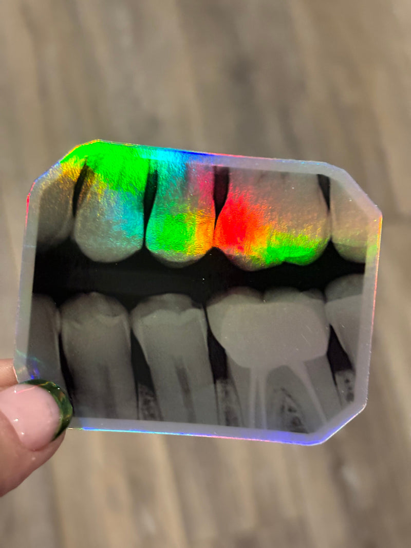 Dental Xray Sticker