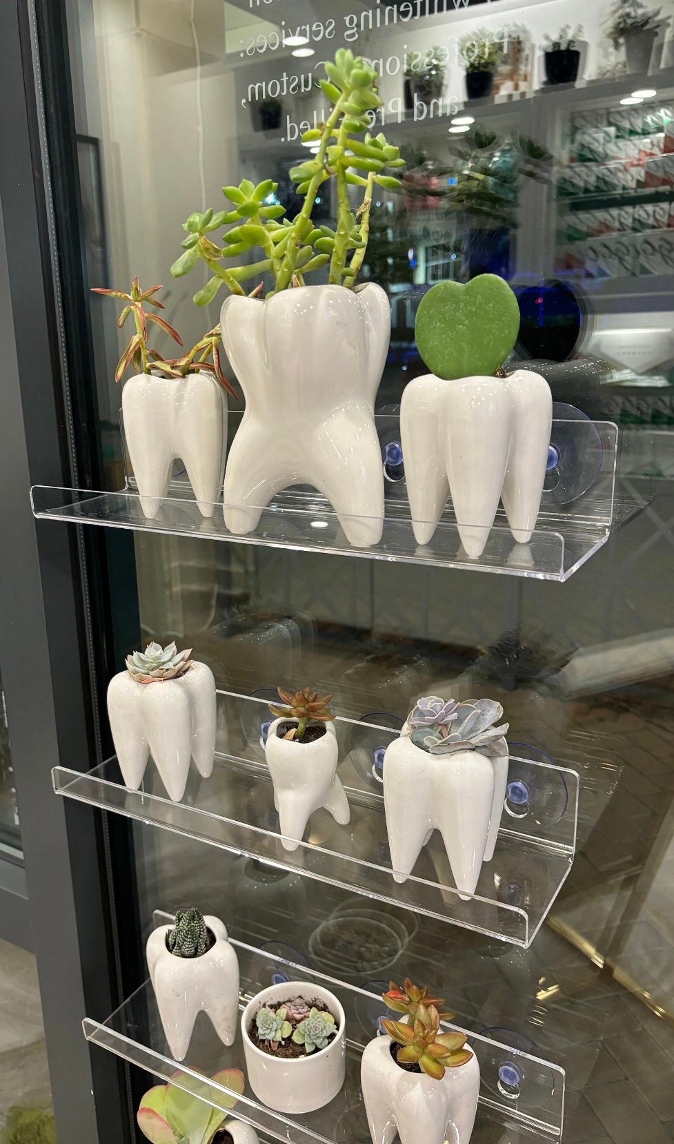 Molar Vase, Dental Molar Vase, Dental Tooth Vase, Molar Tooth, Dentist Gift, Desk Decor, Dental Office or Dental Lab Decor