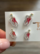 Root Canal Earrings, ENDO Earrings, Dental Anatomy, Dental Earrings, RCT Earrings, Dental Nerves Earrings, Dental Gift