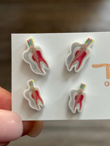 Root Canal Earrings, ENDO Earrings, Dental Anatomy, Dental Earrings, RCT Earrings, Dental Nerves Earrings, Dental Gift