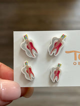 Root Canal Earrings, ENDO Earrings, Dental Anatomy, Dental Earrings, RCT Earrings, Dental Nerves Earrings, Dental Gift