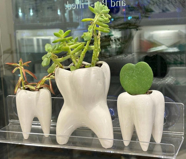 Molar Vase, Dental Vase, Tooth Vase, Dental Planter, Tooth Planter, Dental Hygiene Gift, Dental Succulents, Tooth Succulent, Tooth Shape Pot