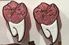 Glitter Pink Denture Earrings