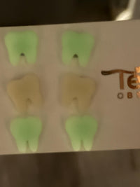Halloween Glow Tooth Earrings | Mummy Tooth, Tooth Cat, Bones & Ghost Tooth | Dental Halloween Earrings | Dental Assistant Hygienist