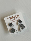 Orange Glitter Tooth Earrings, Dental Studs, Dental Gift, Molar Teeth, Molar Earrings, Dental Assistant, Dental Hygiene