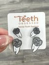 Grey Glitter Tooth Earrings, Dental Studs, Silver Dental Gift, Molar Teeth, Molar Earrings, Dental Assistant, Dental Hygiene