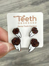 Orange Glitter Tooth Earrings, Dental Studs, Dental Gift, Molar Teeth, Molar Earrings, Dental Assistant, Dental Hygiene