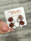 Orange Glitter Tooth Earrings, Dental Studs, Dental Gift, Molar Teeth, Molar Earrings, Dental Assistant, Dental Hygiene