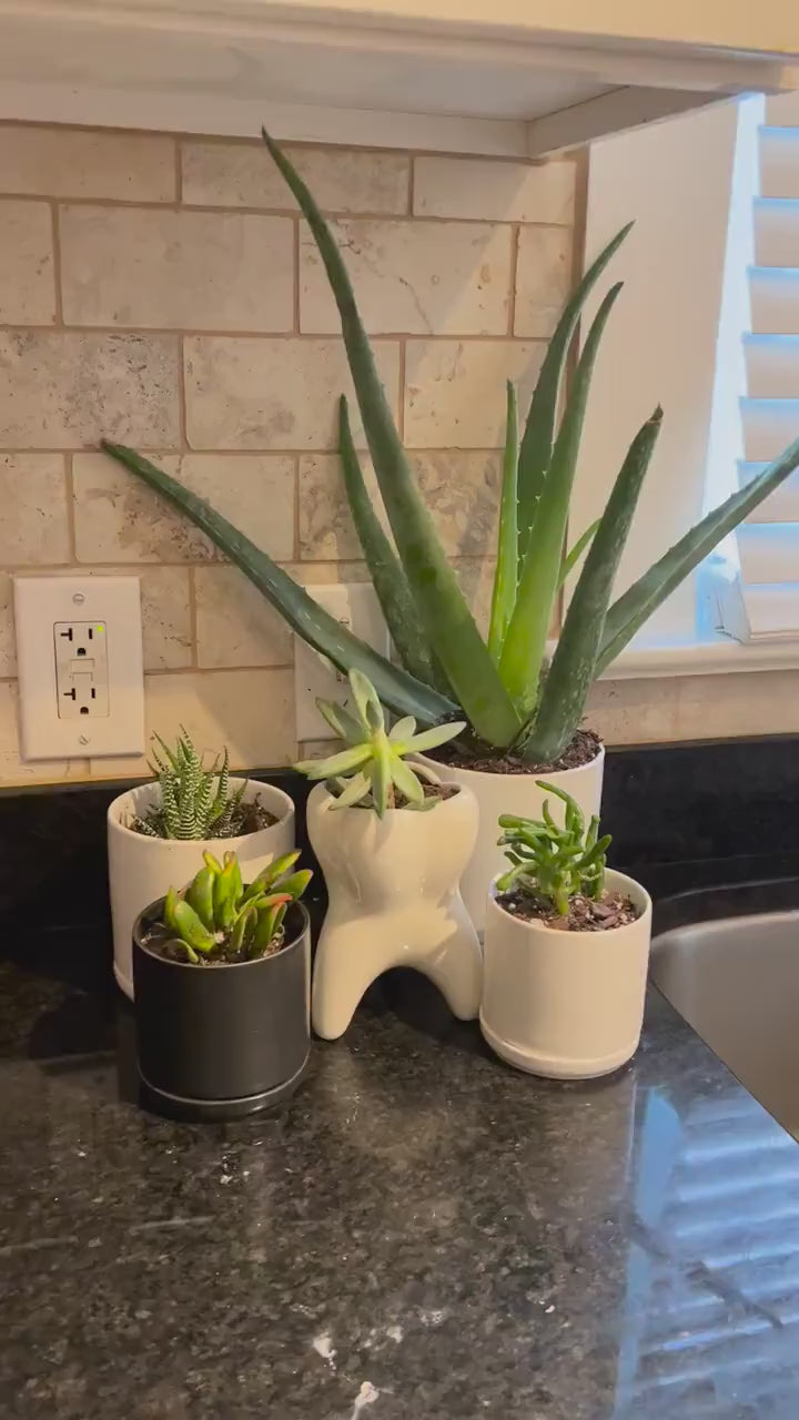 Molar Vase: Dental Planter for Succulents or Pens