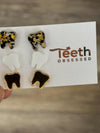 Glitter Dental Earrings, Red Teeth Earrings, Tooth Earrings, Tooth Earrings, Dental Hygiene Gift Dental Assistant, Dental Graduation