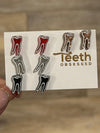 Black RCT Dental Earrings by Teeth Obsessed featuring realistic tooth-shaped dental jewelry on posts.
