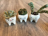 Set of three smiling tooth-shaped vases and planters with succulents, by Teeth Obsessed, showcasing playful dental-themed decor.